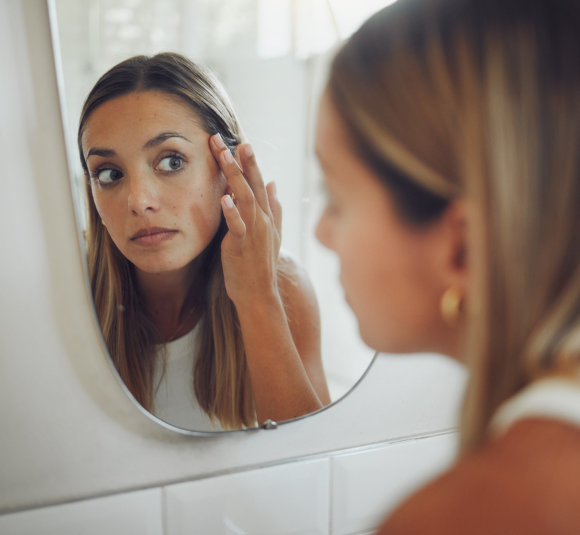 expert-approach-to-hyperpigmentation