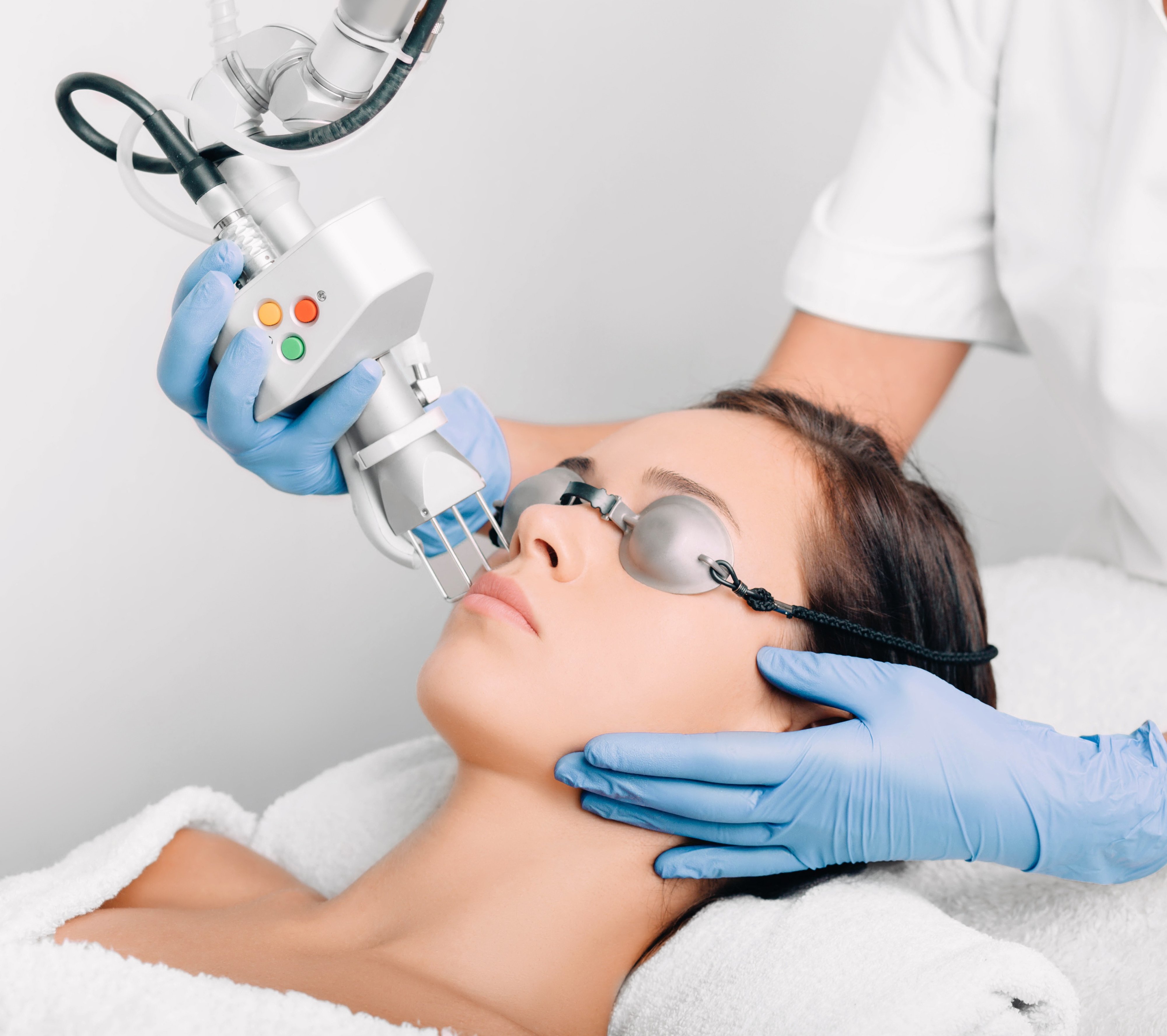 laser-skin-treatments-in-fort-lauderdale-for-skin-damage-clear-acne