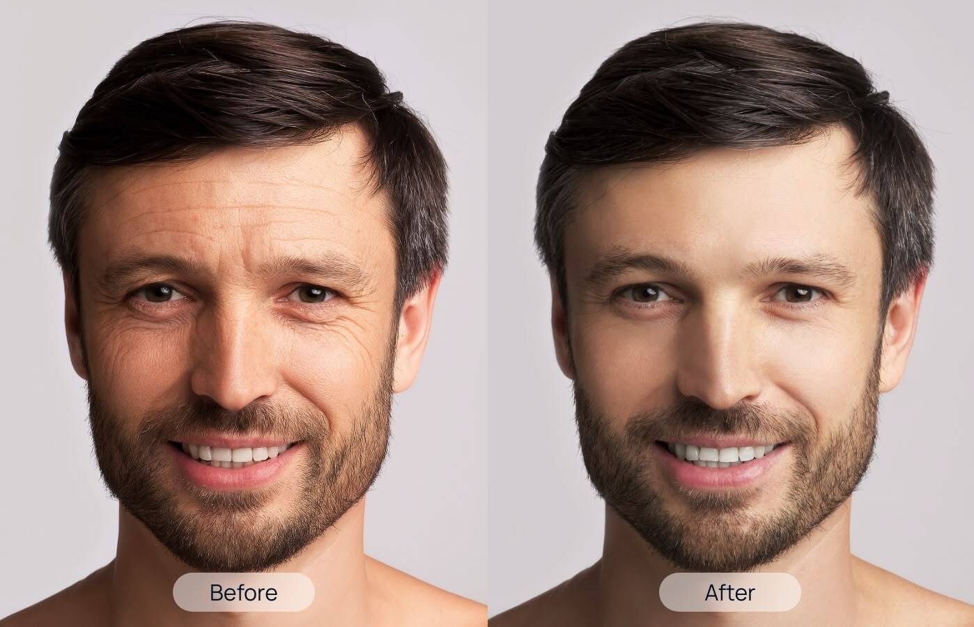 Shino-Bay-Treatment-Before-After-1