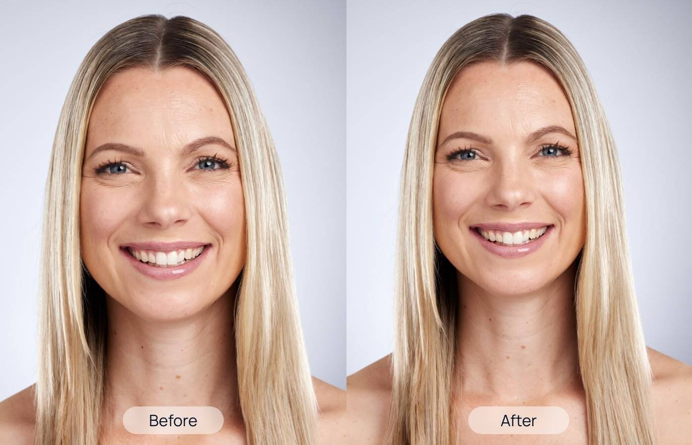 Shino-Bay-Treatment-Before-After-2