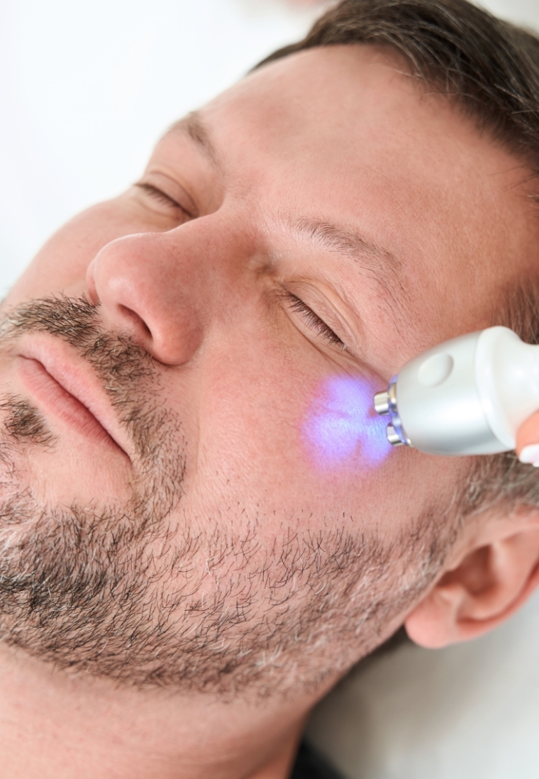 clear-brilliant-bbl-shino-bay