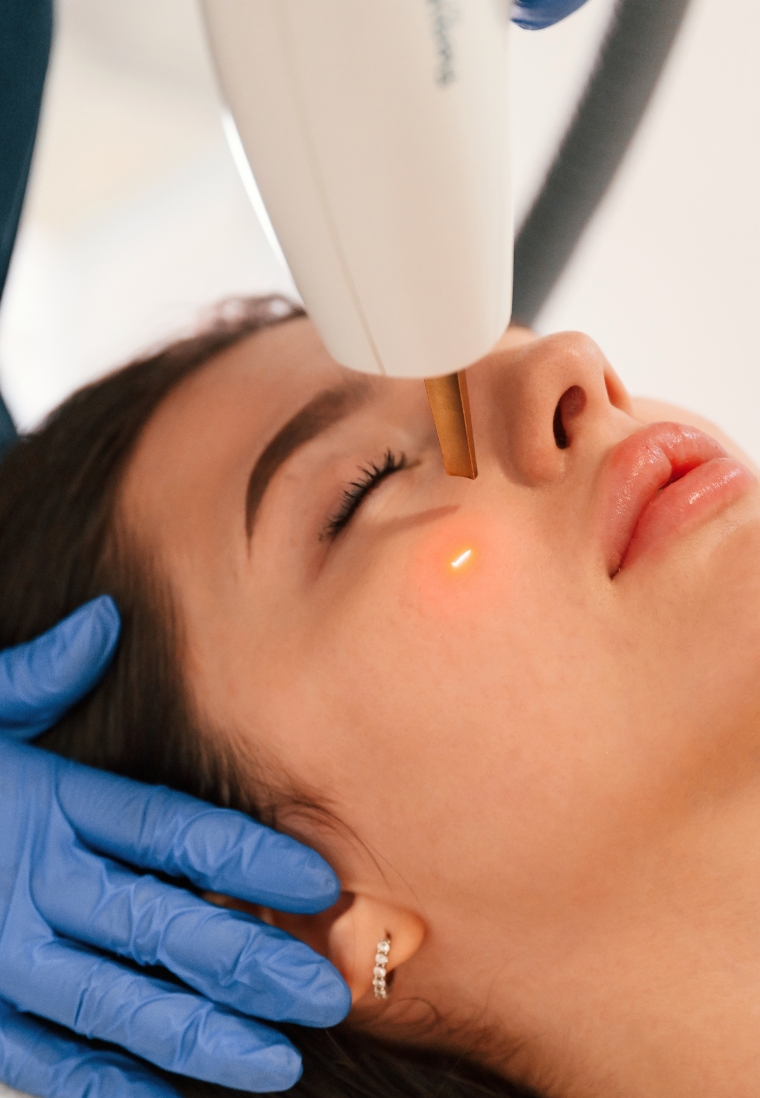 laser-treatments-shino-bay