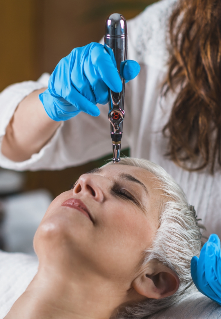 rf-microneedling-shino-bay