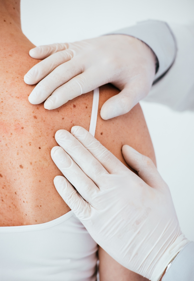 skin-tightening-shino-bay-2