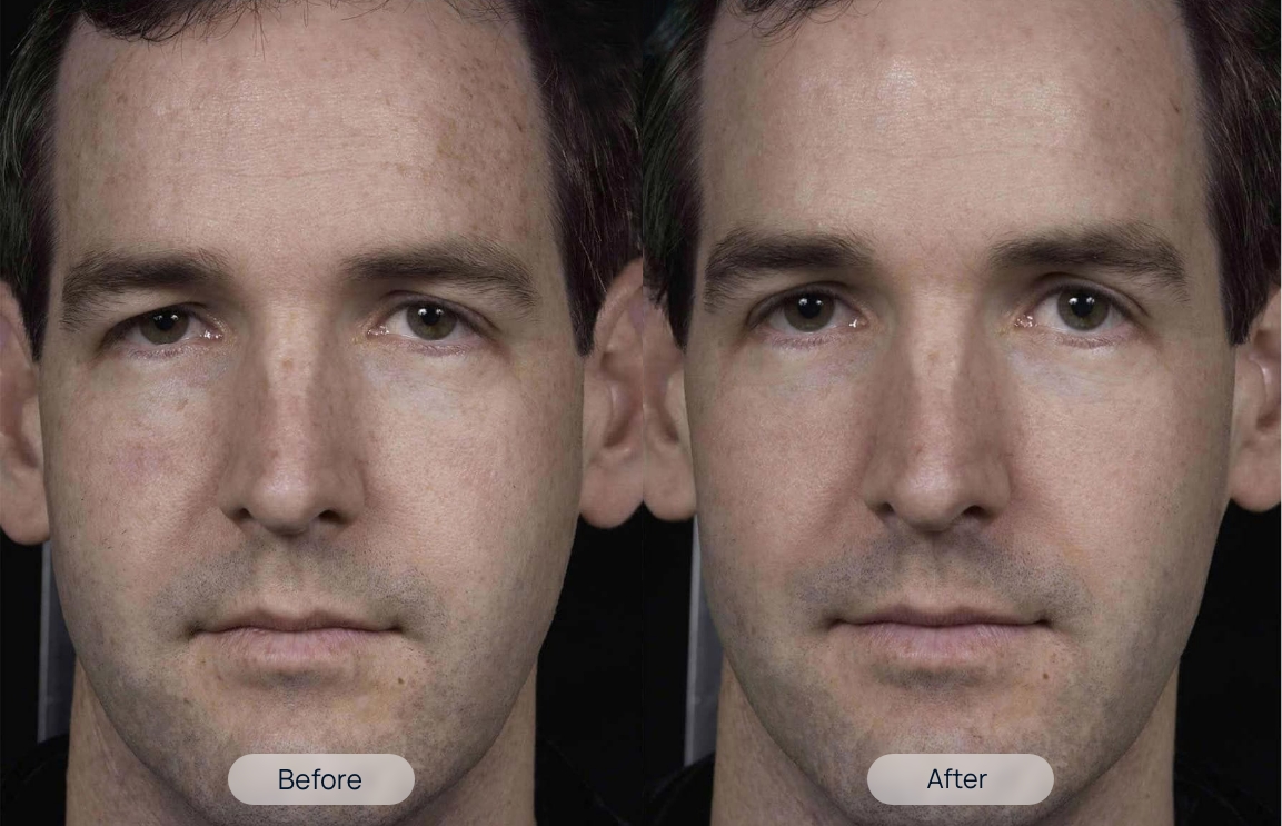 treatment-before-after-1-1