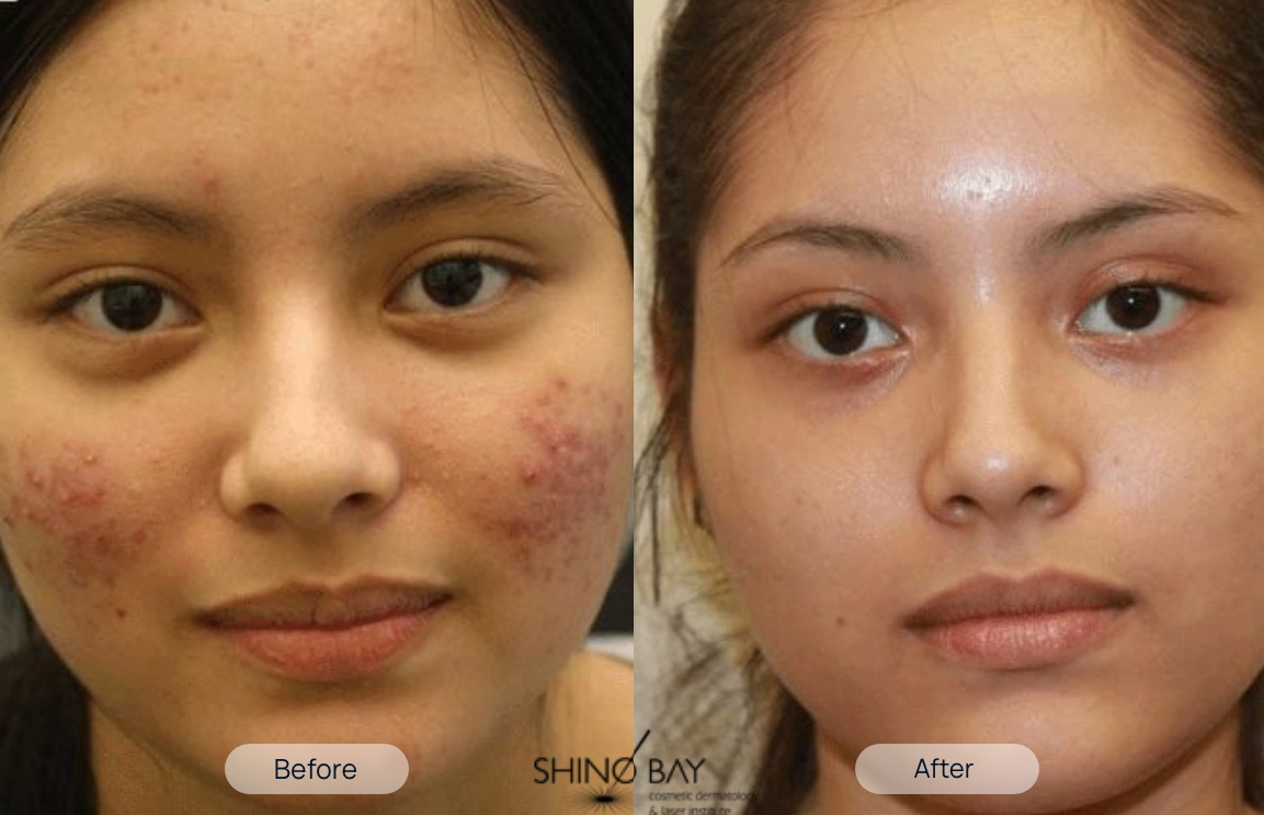 treatment-before-after-2-1