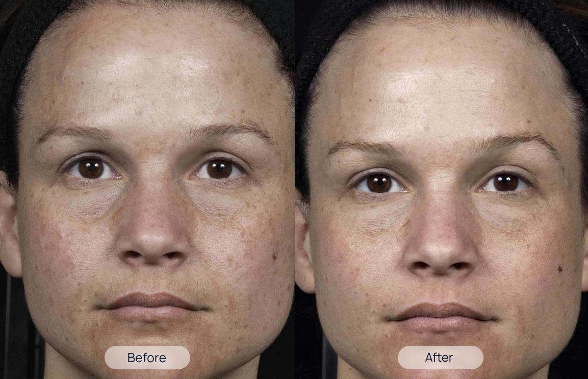 treatment-before-after-2-2