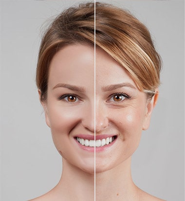 Dermatology Procedures - Neurotoxin Service - Shino Bay - Fort Lauderdale
