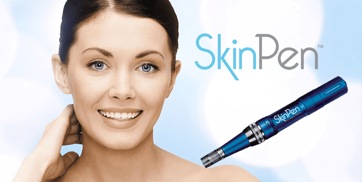 SKINPEN