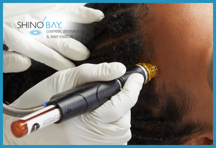 GIVE YOUR SCALP SOME LOVE WITH HYDRAFACIAL KERAVIVE!